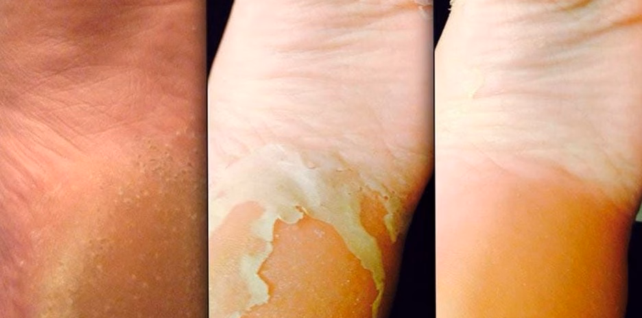 Pourquoi exfolier la peau régulièrement change vraiment tout